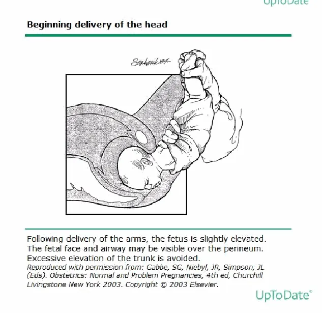 Figure from the guideline