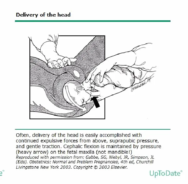 Figure from the guideline